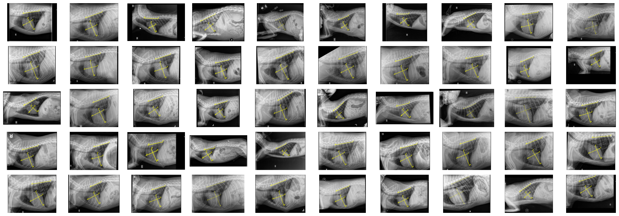 CCK Dataset Sample Images